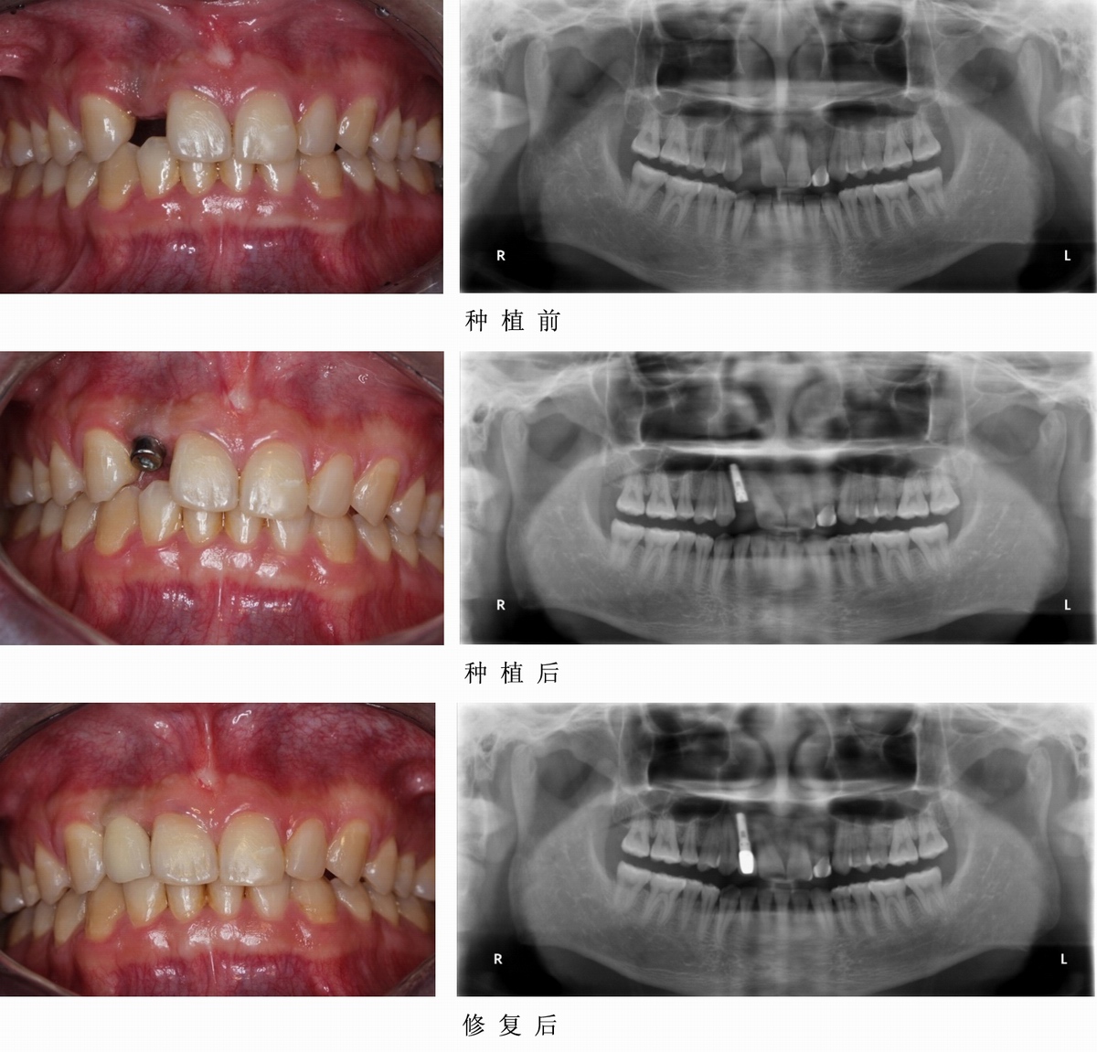 沐鸣娱乐_沐鸣平台登录-官方授权注册效劳中心