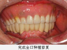 沐鸣娱乐_沐鸣平台登录-官方授权注册效劳中心