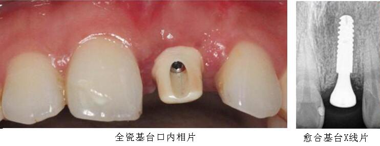 沐鸣娱乐_沐鸣平台登录-官方授权注册效劳中心