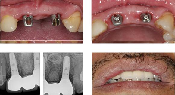 沐鸣娱乐_沐鸣平台登录-官方授权注册效劳中心