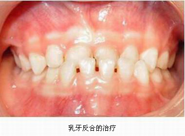 沐鸣娱乐_沐鸣平台登录-官方授权注册效劳中心