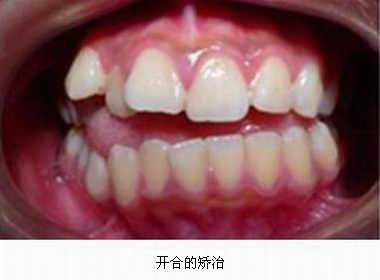 沐鸣娱乐_沐鸣平台登录-官方授权注册效劳中心