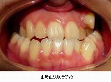 沐鸣娱乐_沐鸣平台登录-官方授权注册效劳中心