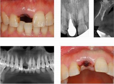 沐鸣娱乐_沐鸣平台登录-官方授权注册效劳中心